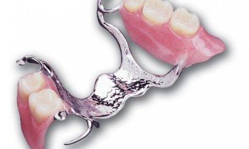 Biugeliniai dantų protezai